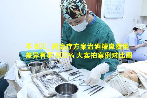 不 🕸 同治疗方案治酒糟鼻费用差异有多 🌾 大实拍案例对比图揭示
